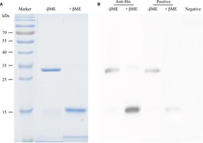 Immunotherapy With Recombinant Alt a 1 Suppresses Allergic Asthma and Influences T Follicular Cells and Regulatory B Cells in Mice